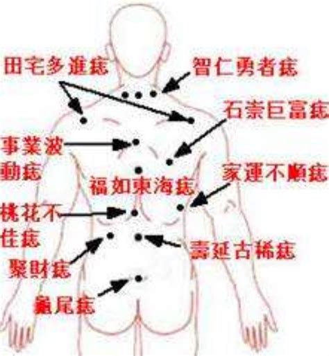 屁股痣位置|痣在屁股有何寓意？